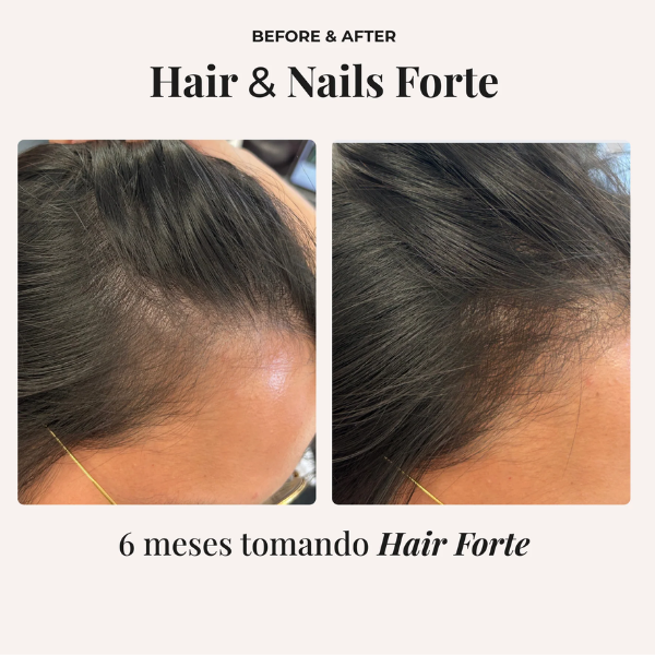 Beneficios de las vitaminas para cabello y uñas